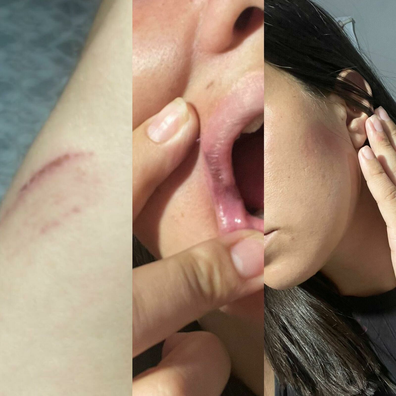 Imagem de compartilhamento para o artigo Jovem que foi agredida por companheiro detalha ataques em Figueirão: Só não me matou porque escondi a faca da MS Todo dia